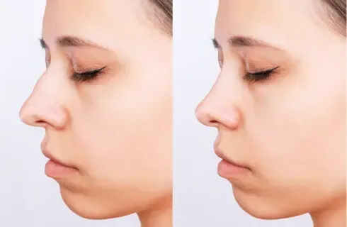 Victoria James's before and after simulation