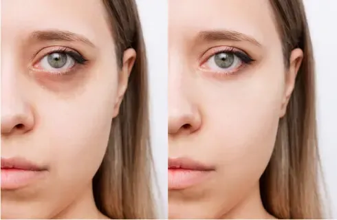 Marry Booth's before and after simulation