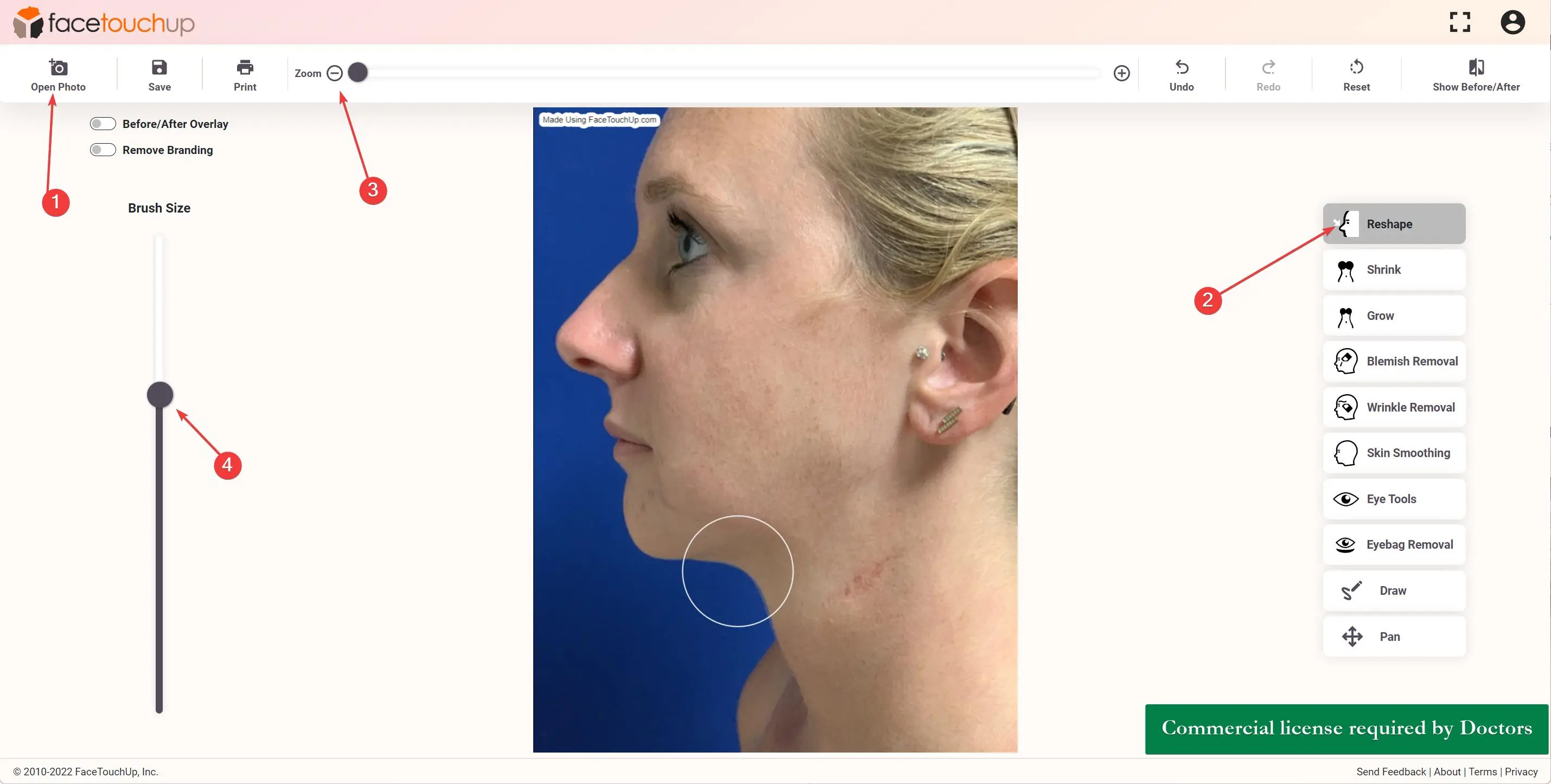FaceTouchUp chin and neck lift simulation - Before photo