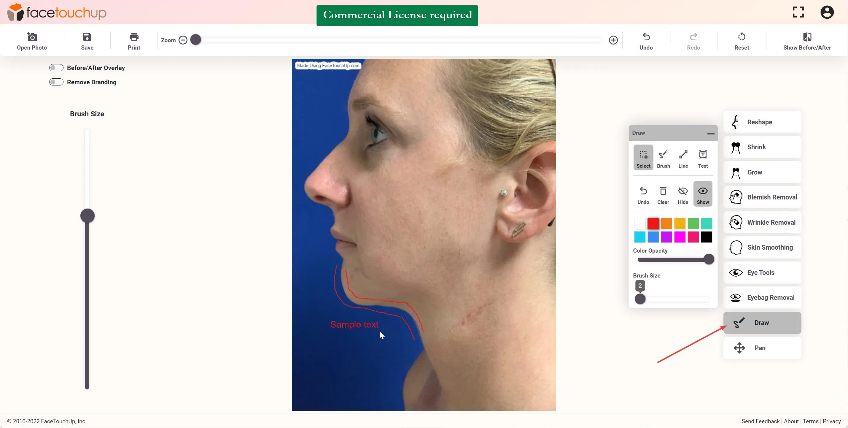FaceTouchUp chin and neck lift simulation - Editing the chin and neck contour
