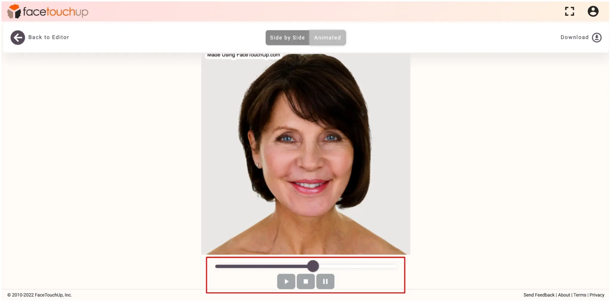 How to simulate chin and neck lift step 3