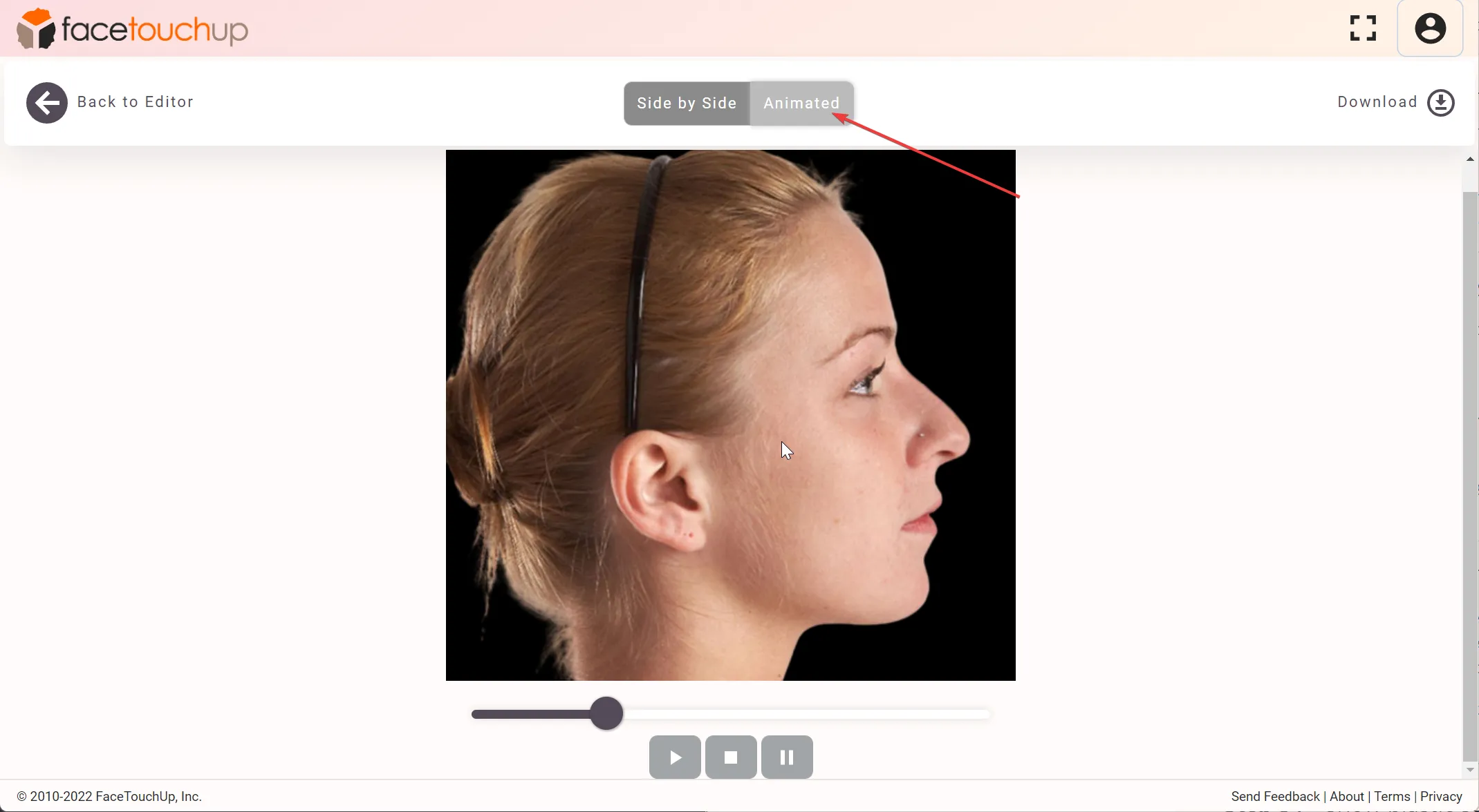 How to simulate rhinoplasty step 6