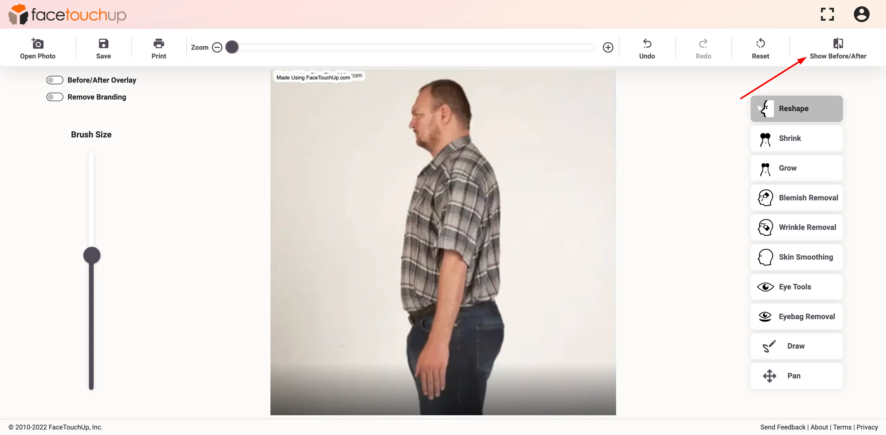 FaceTouchUp bariatric surgery simulator - Step 6: Refine the leg area