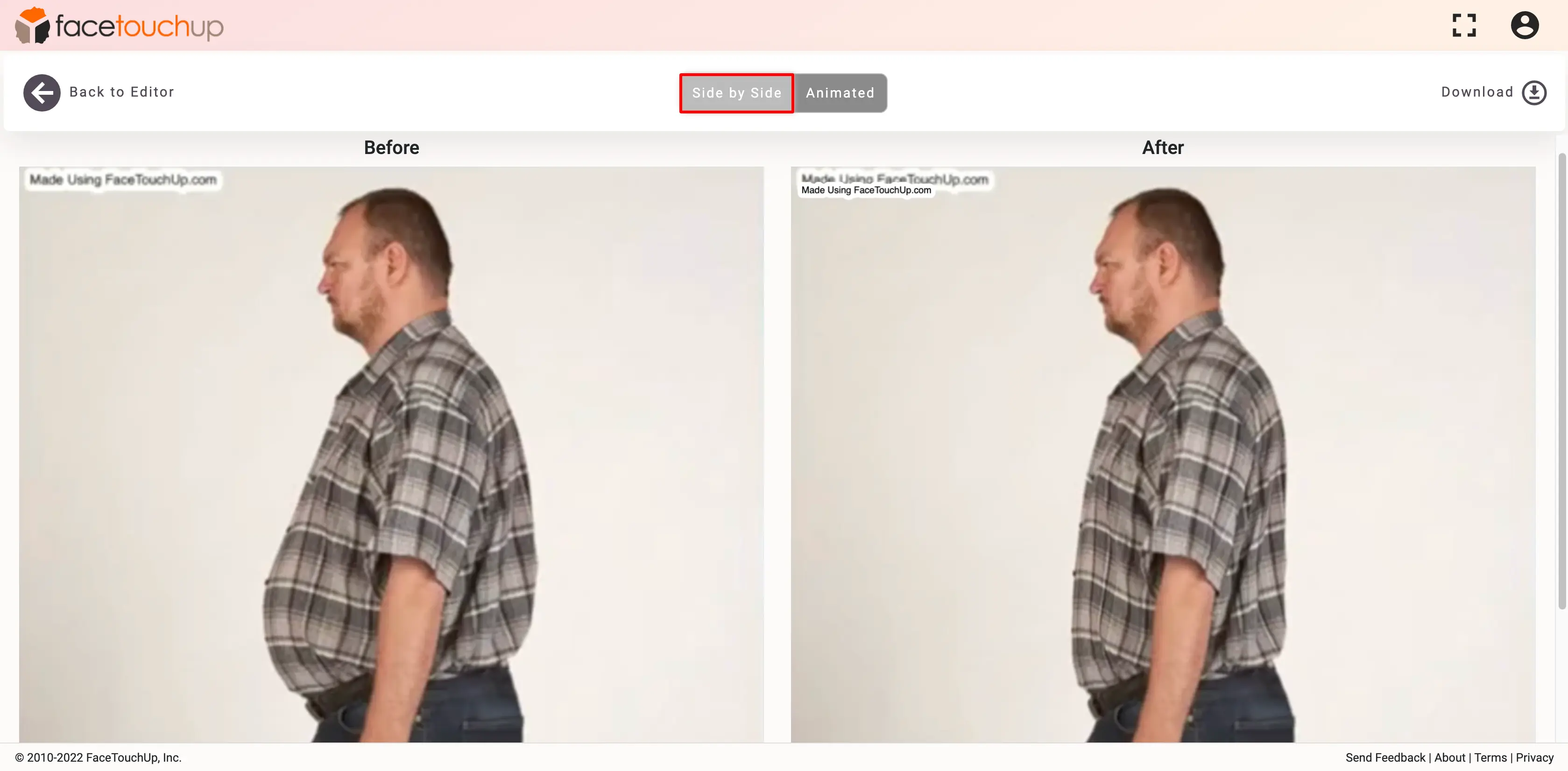 FaceTouchUp bariatric surgery simulator - Step 7: Smooth and blend adjustments