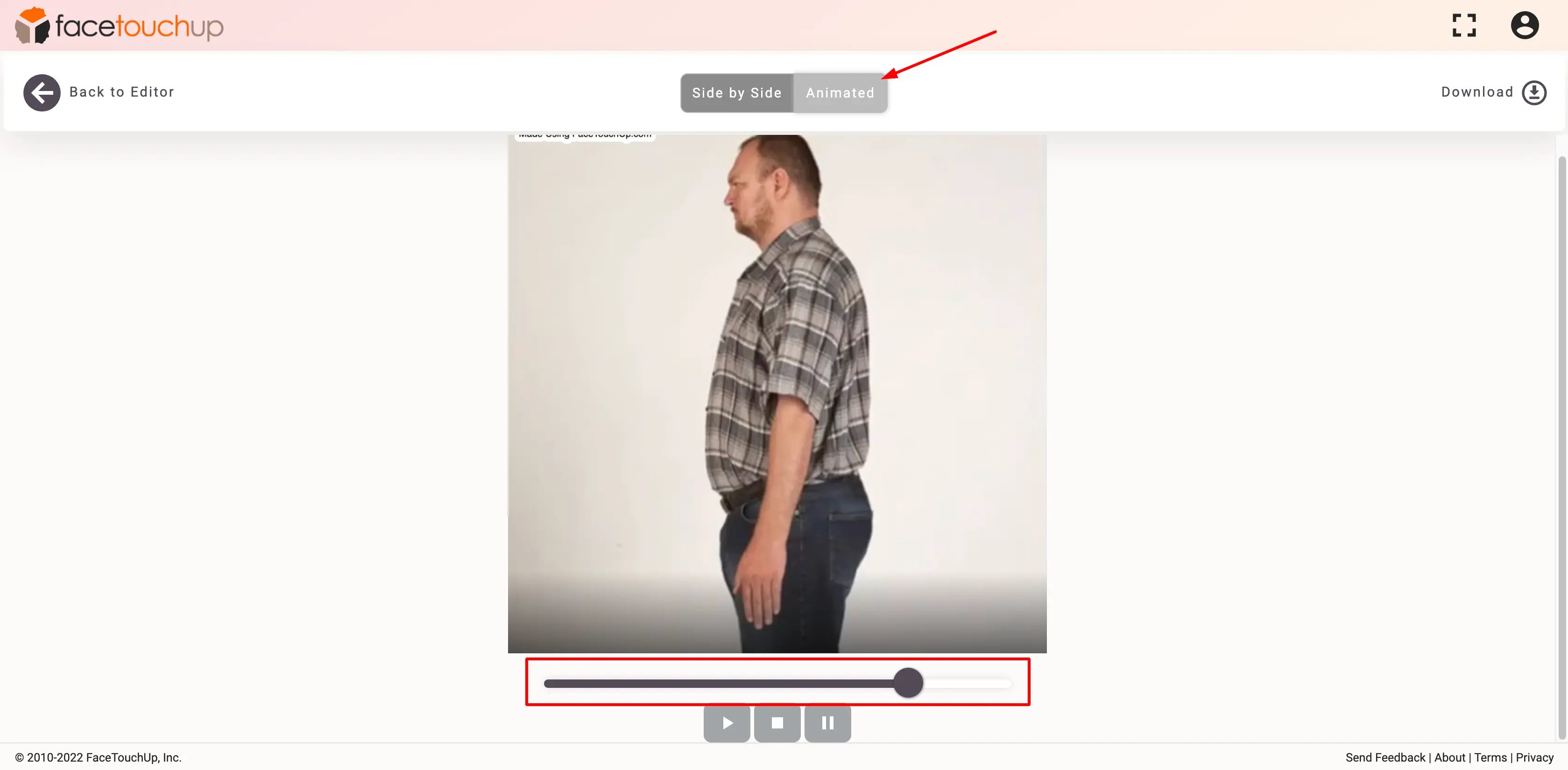FaceTouchUp bariatric surgery simulator - Step 8: Compare before and after results